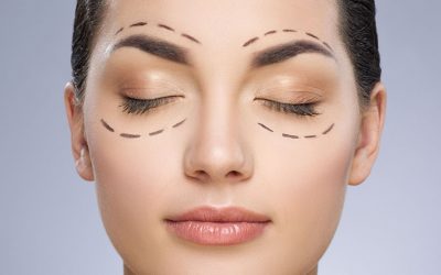 Blefaroplastika – operácia očných viečok
