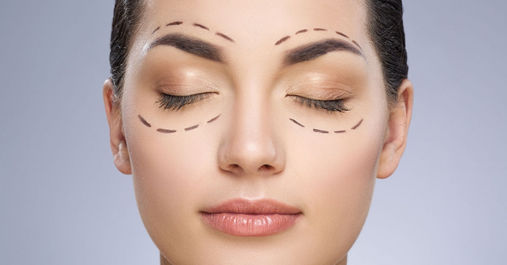 Blefaroplastika – operácia očných viečok